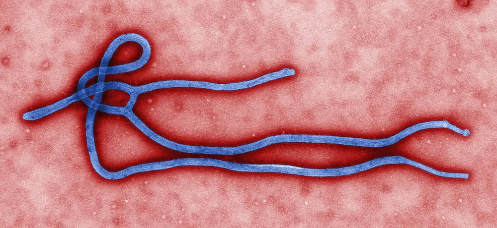 A digitally colorized transmission electron microscopic image of an Ebola virus virion.