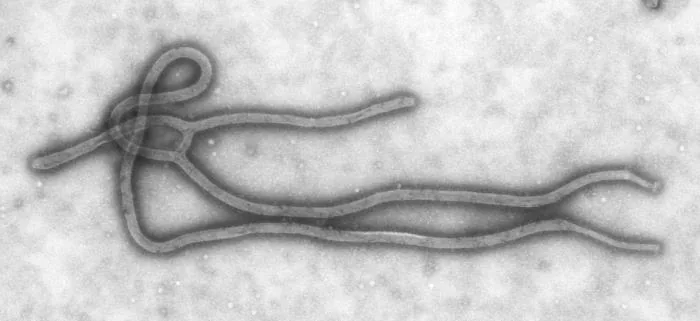 Transmission electron micrograph of Ebola virus particles.